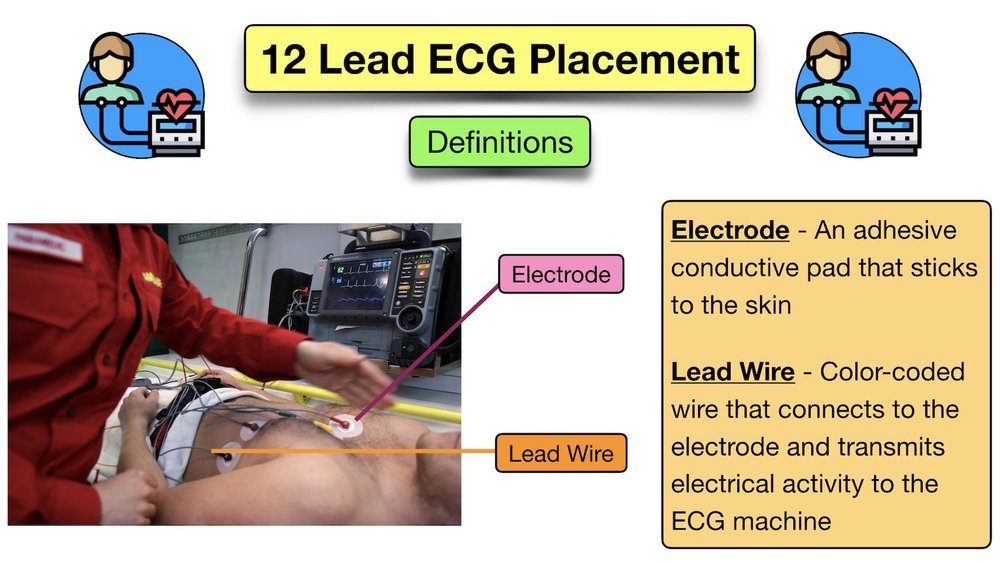 12 Lead ECG Placement Diagram and Mnemonic for Limb and Precordial