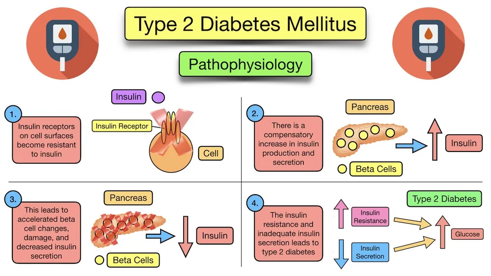 Type 2 Diabetes Mellitus Symptoms, Diet, Medication, Treatment, Risk