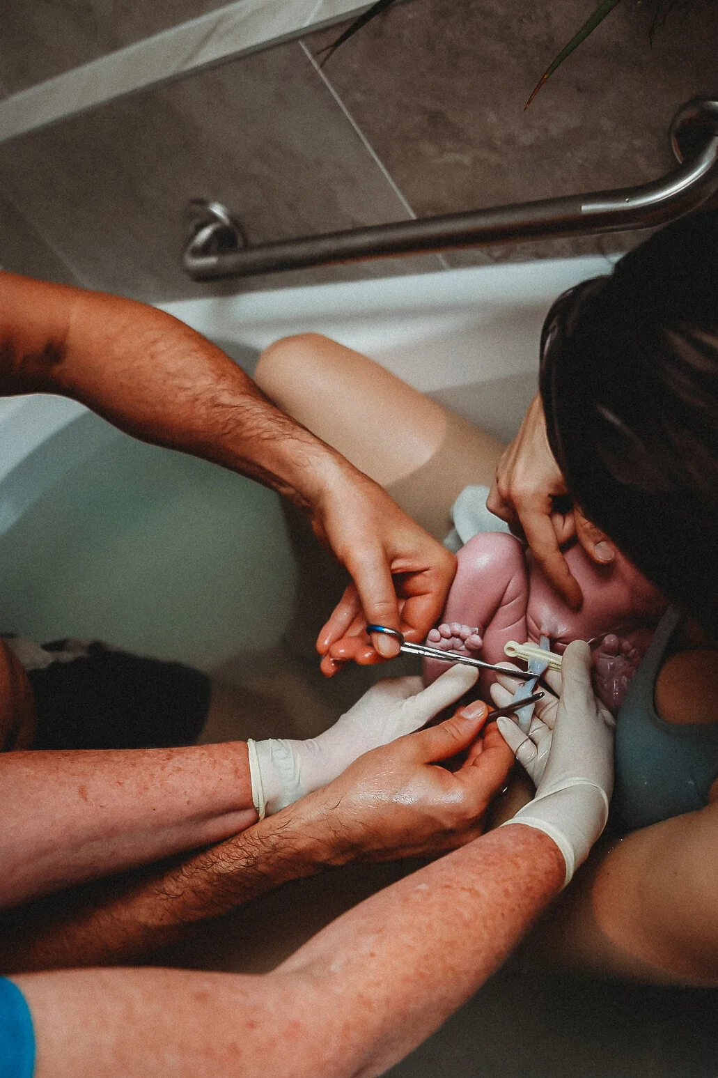 Delayed Cord Clamping