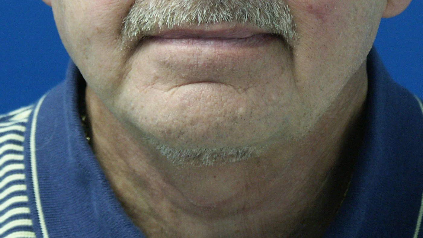 case 506d.jpg
