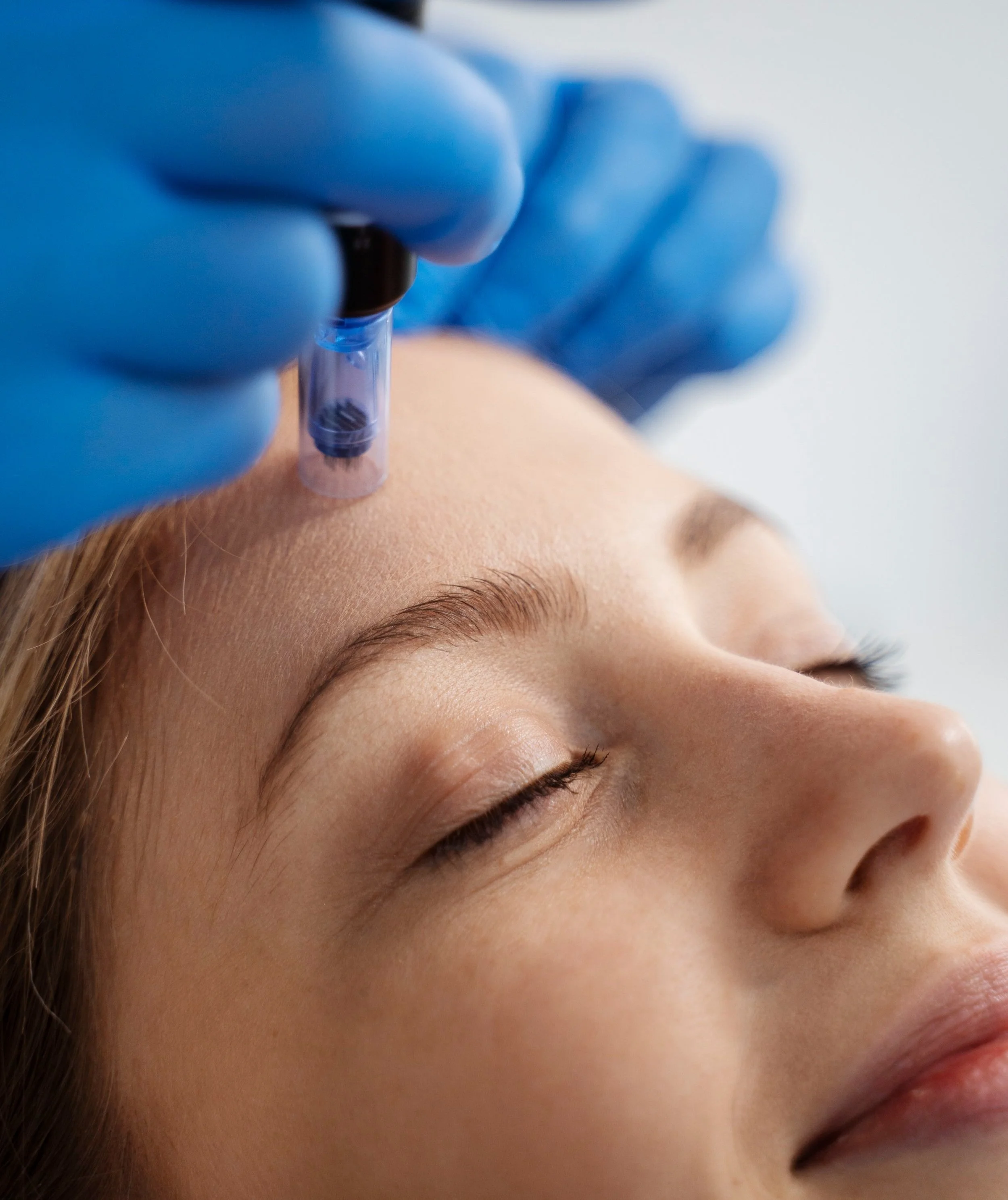 Services — AcuAura Acupuncture