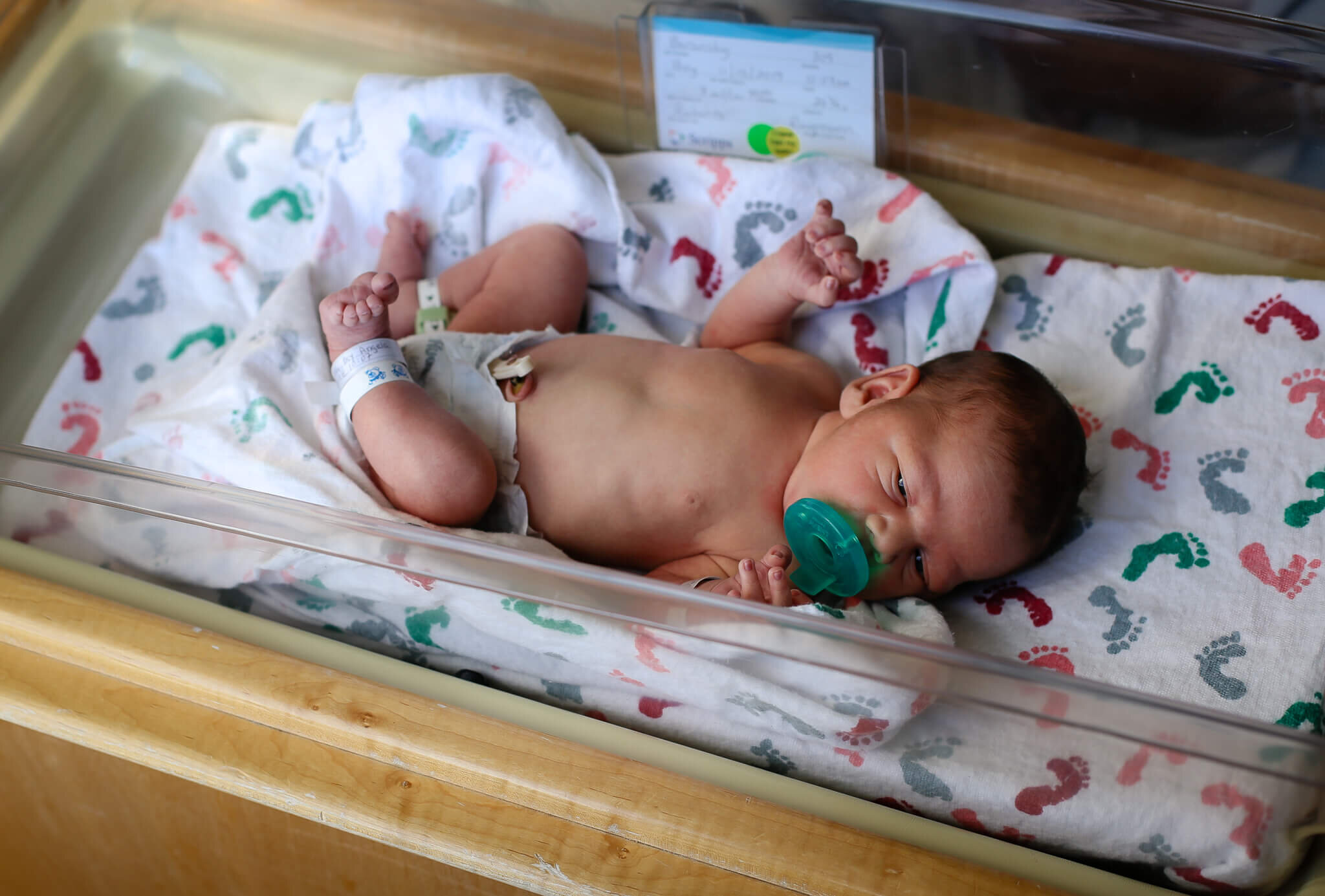  An image of a newborn baby lying in the hospital baby bed, showing his arms and legs and bare belly with the cord clamp from a session of fresh 48 baby pictures 