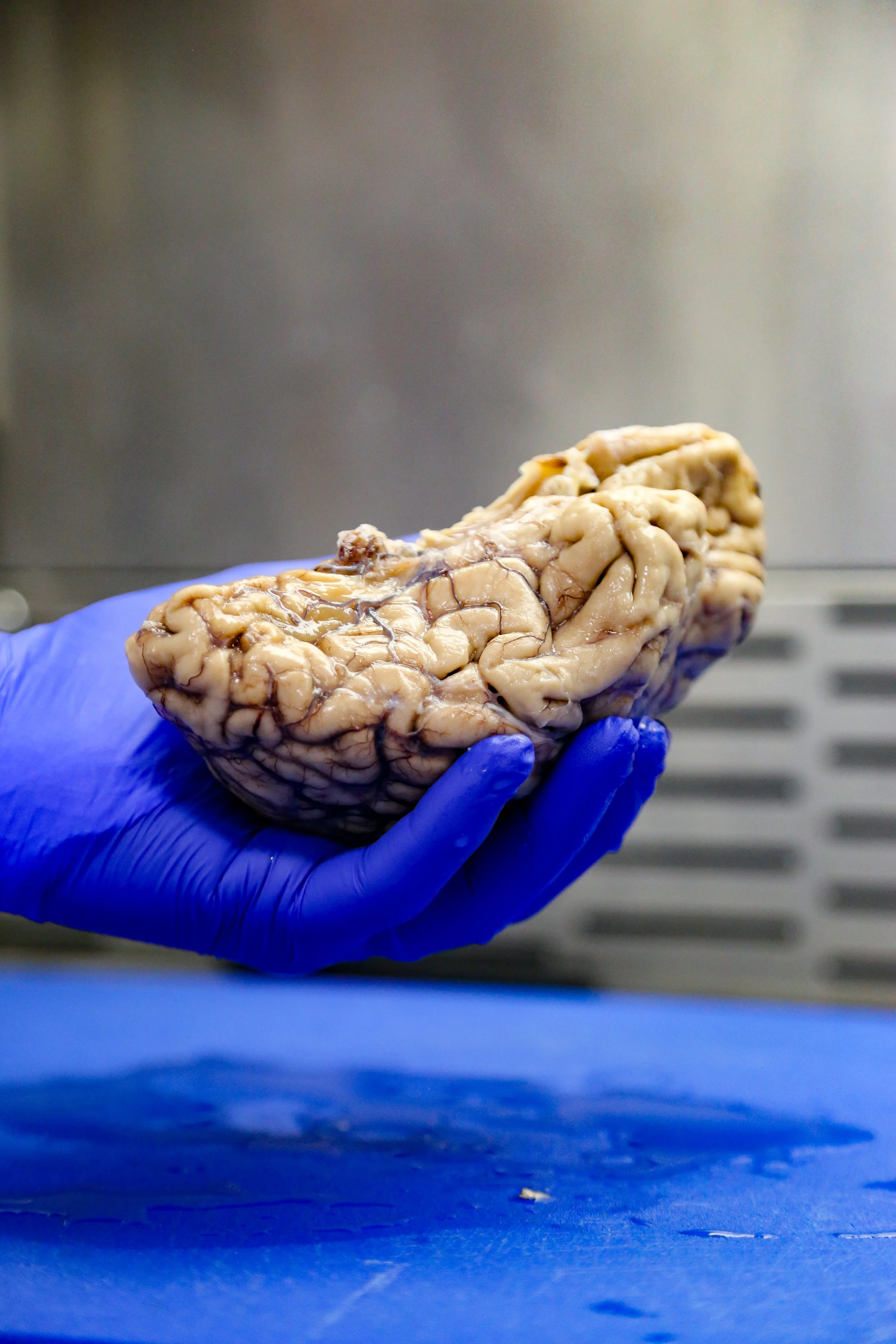 A gloved hand holding a preserved human brain in a laboratory setting.