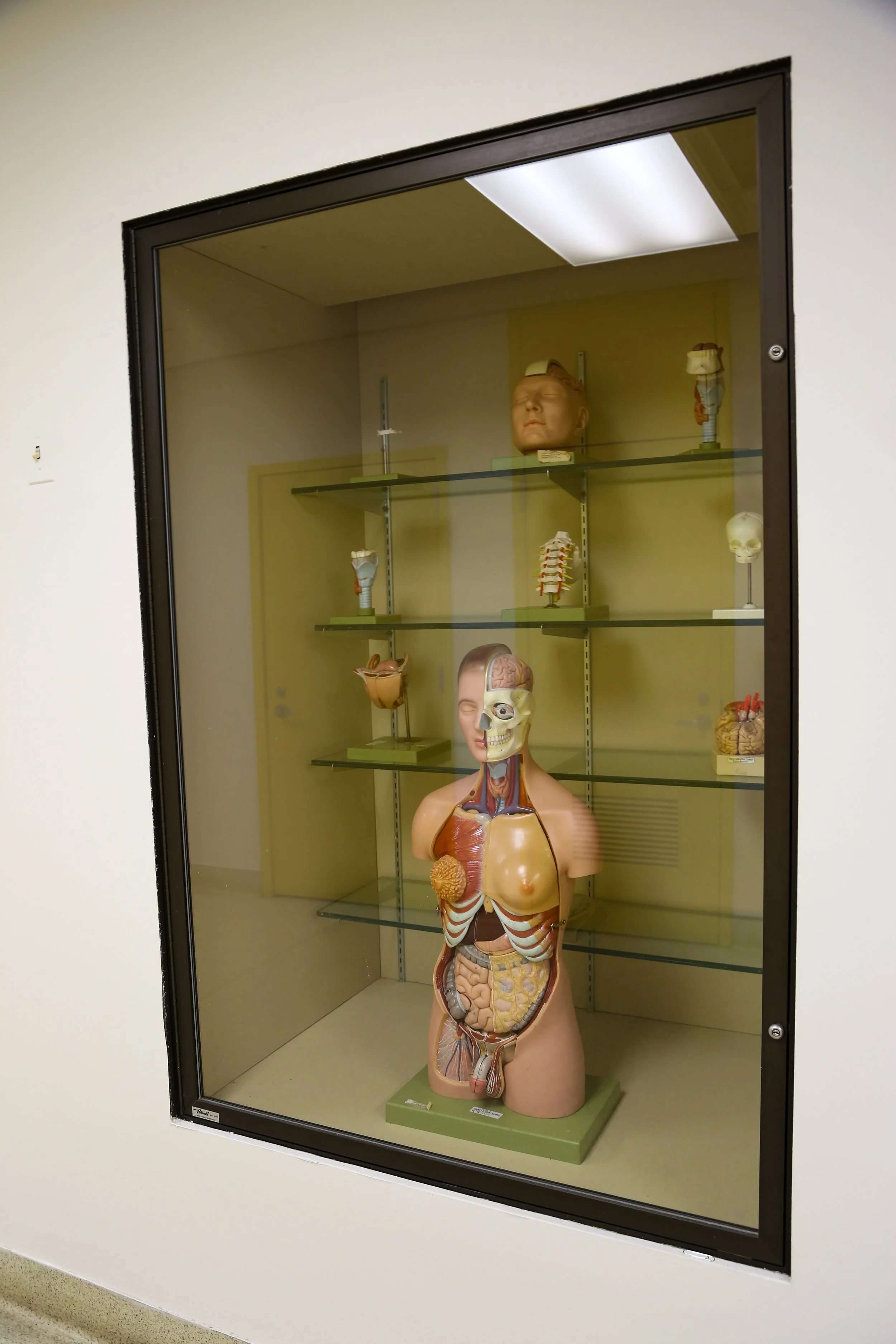An exhibit of anatomical models and specimens behind a glass display case, featuring a large torso model with internal organs, a human skull, and other body parts.