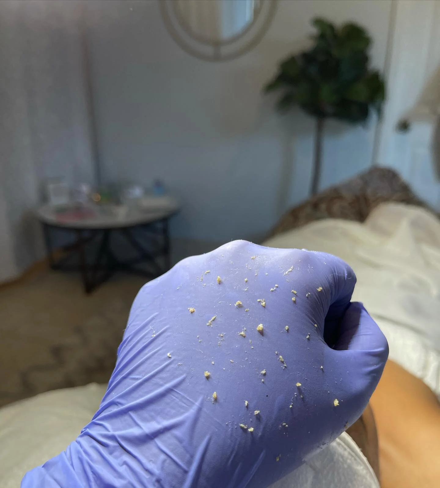 Popping Whiteheads Videos 07 - ji2rid7