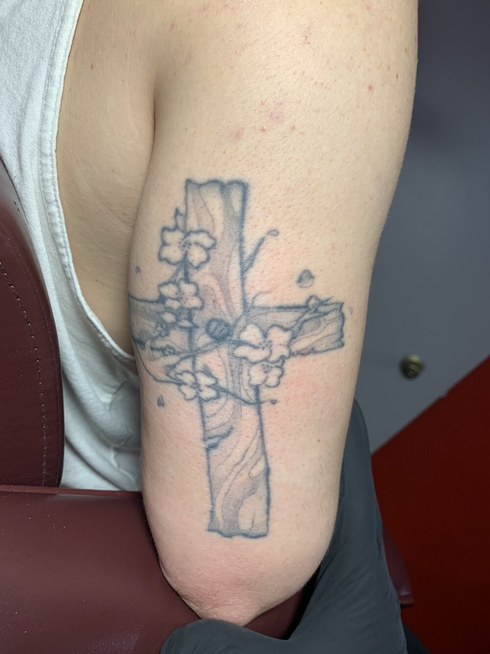 Photo Gallery — Redink Tattoo Removal Photo Gallery — Redink Tattoo Removal