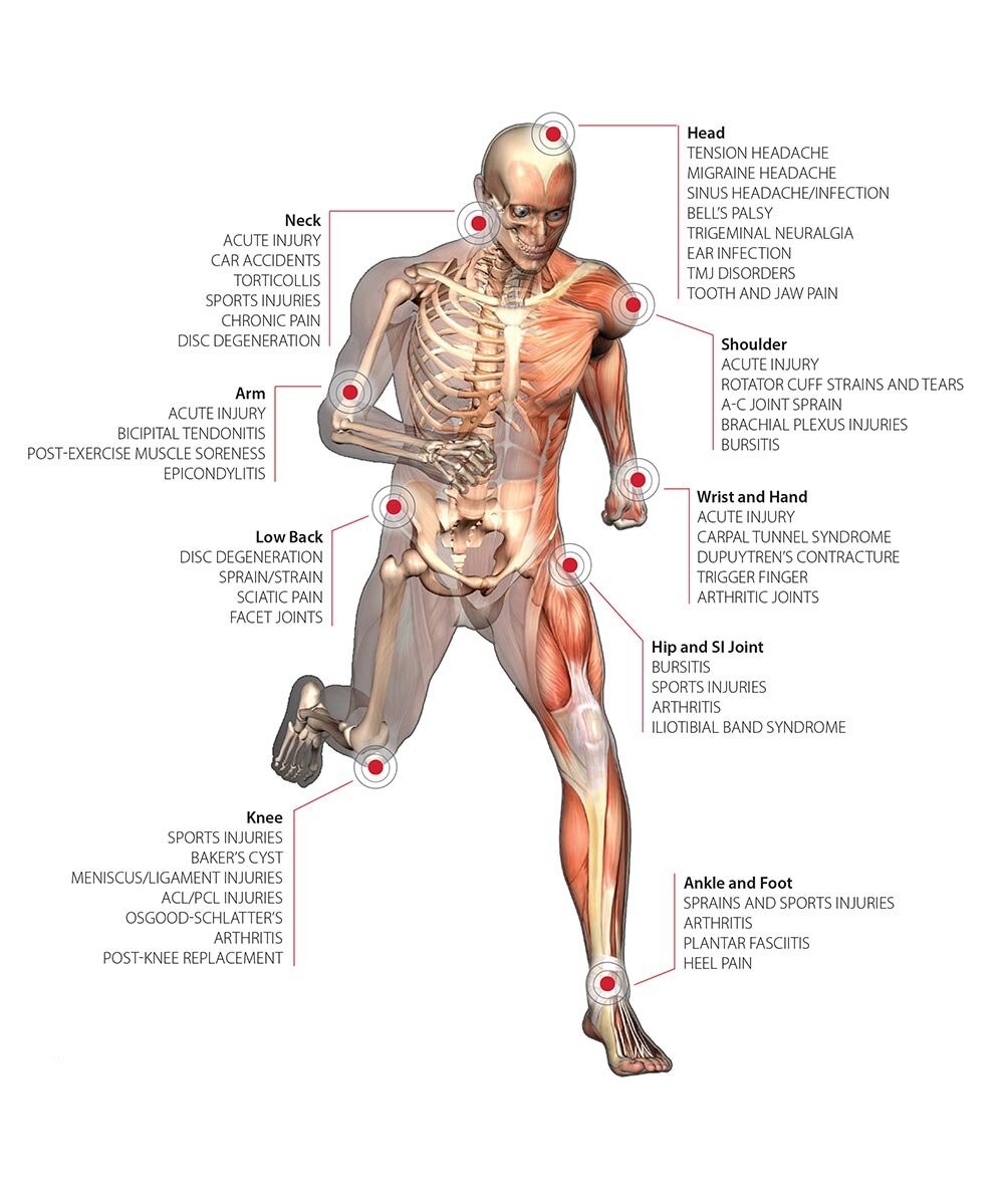 Chiropractic Laser Therapy Machine