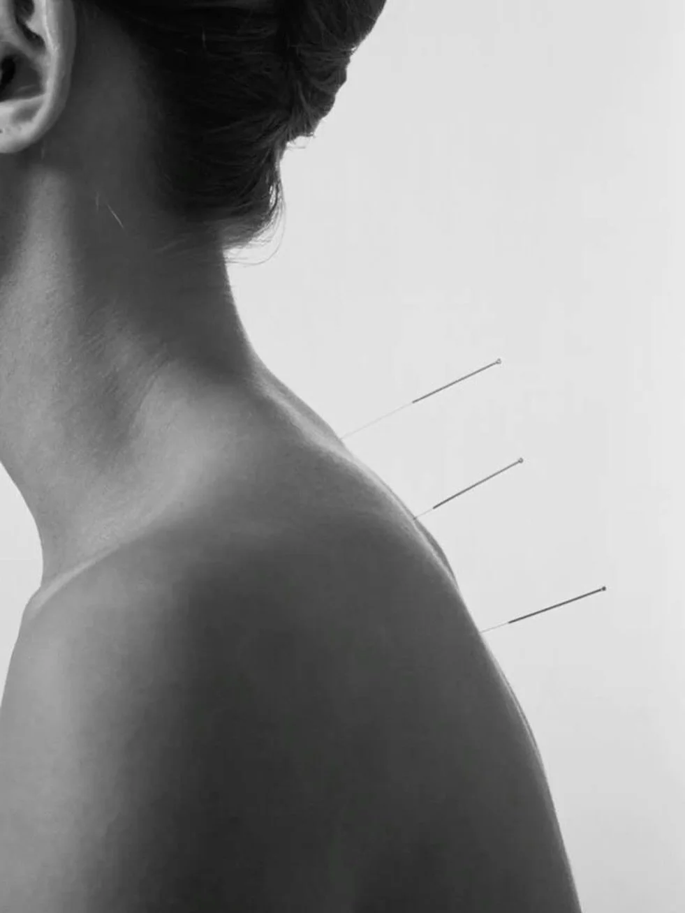 What if pain relief didn&rsquo;t have to come from a pill? 

Acupuncture offers a scientifically backed, drug-free way to manage pain by working with your body&mdash;not against it.

✨ How Acupuncture Helps with Pain Relief (Scientifically Speaking):