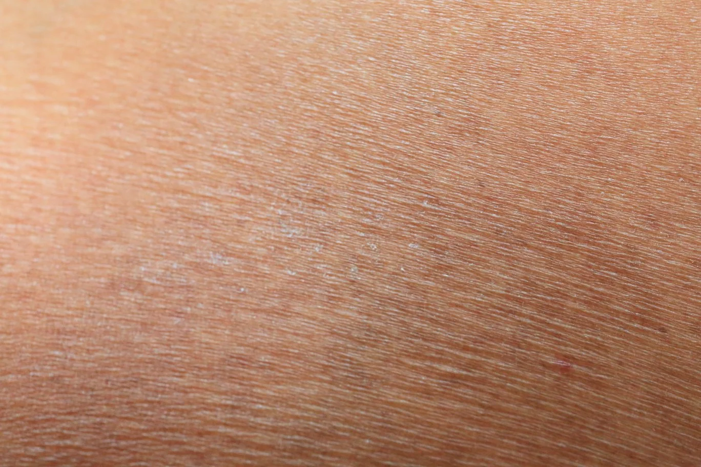 Course Skin 5 Common Skin Concerns | Sokörpe Laboratories — Sokörpe