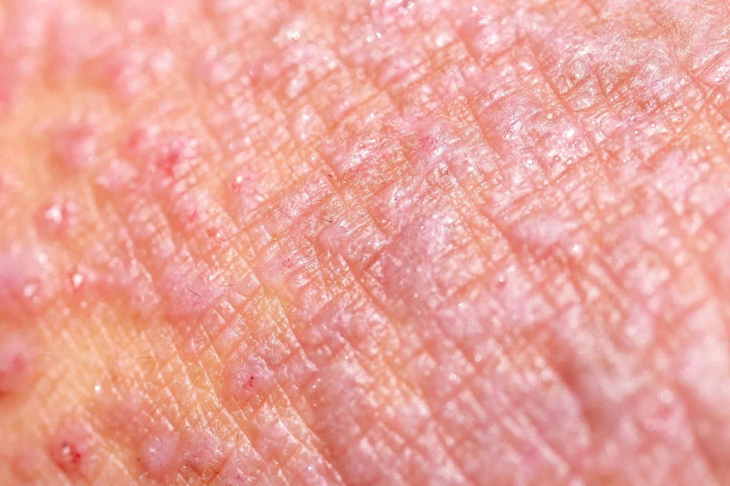 5 Common Skin Concerns