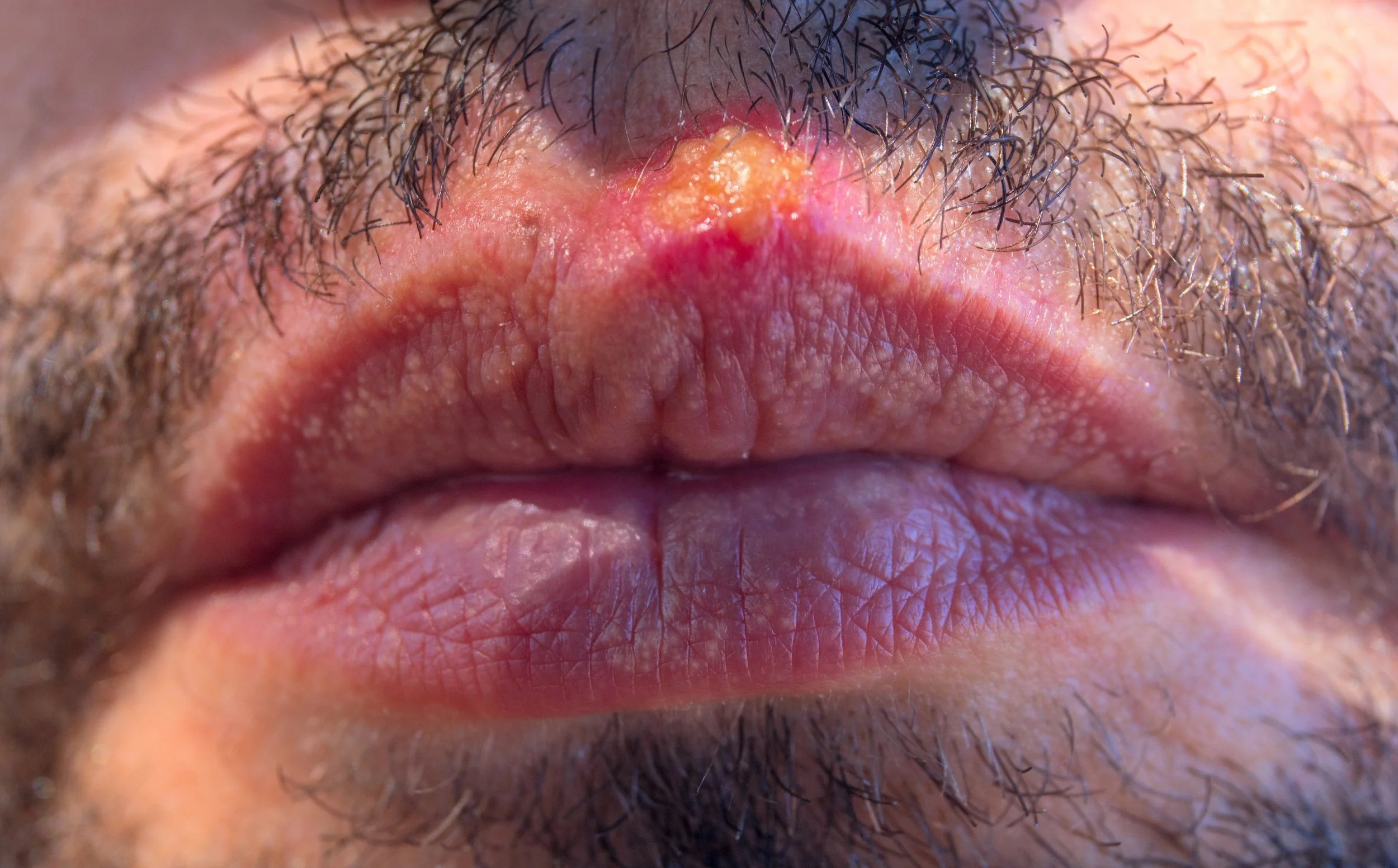 why-is-the-skin-the-first-line-of-defense-against-diseases-sok-rpe
