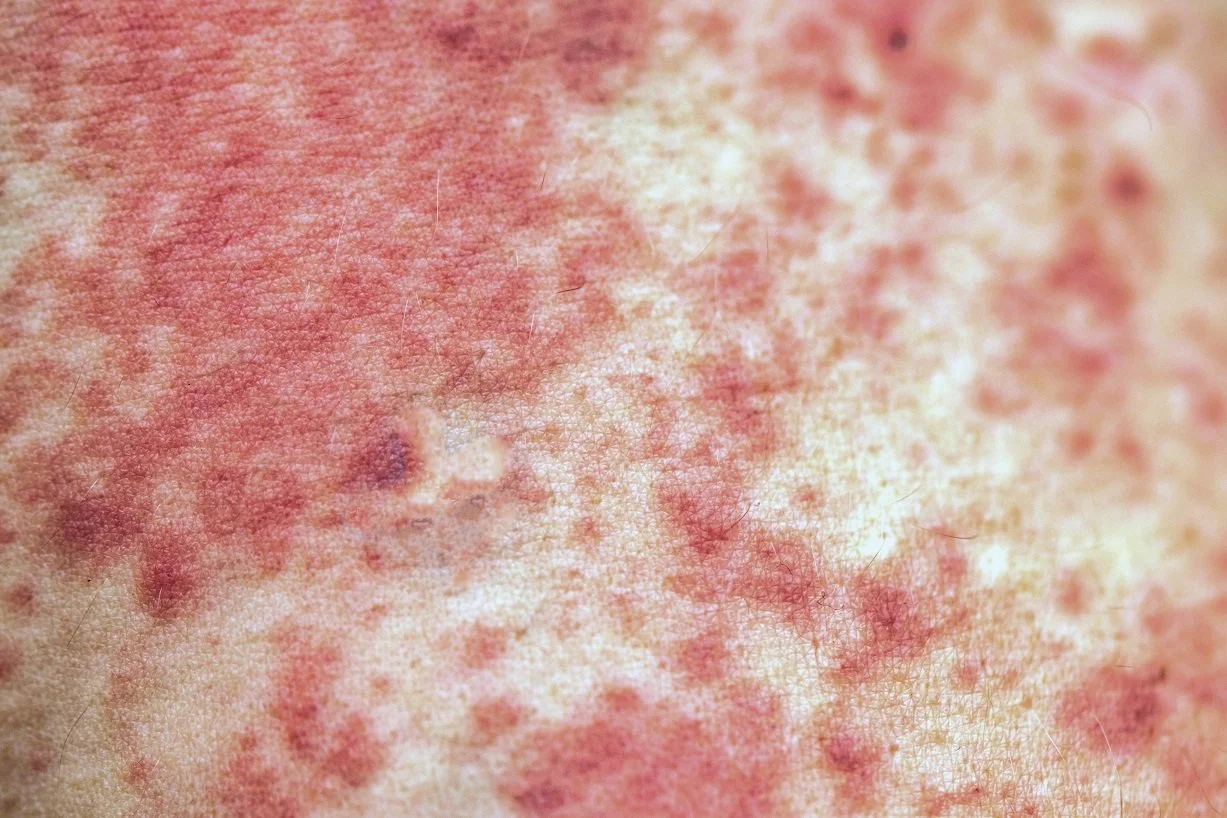 Why is the skin the first line of defense against diseases?