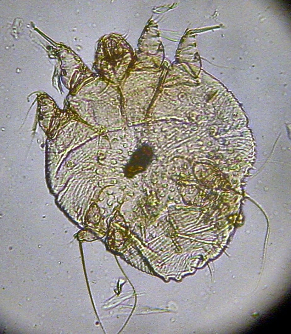 What is Scabies?