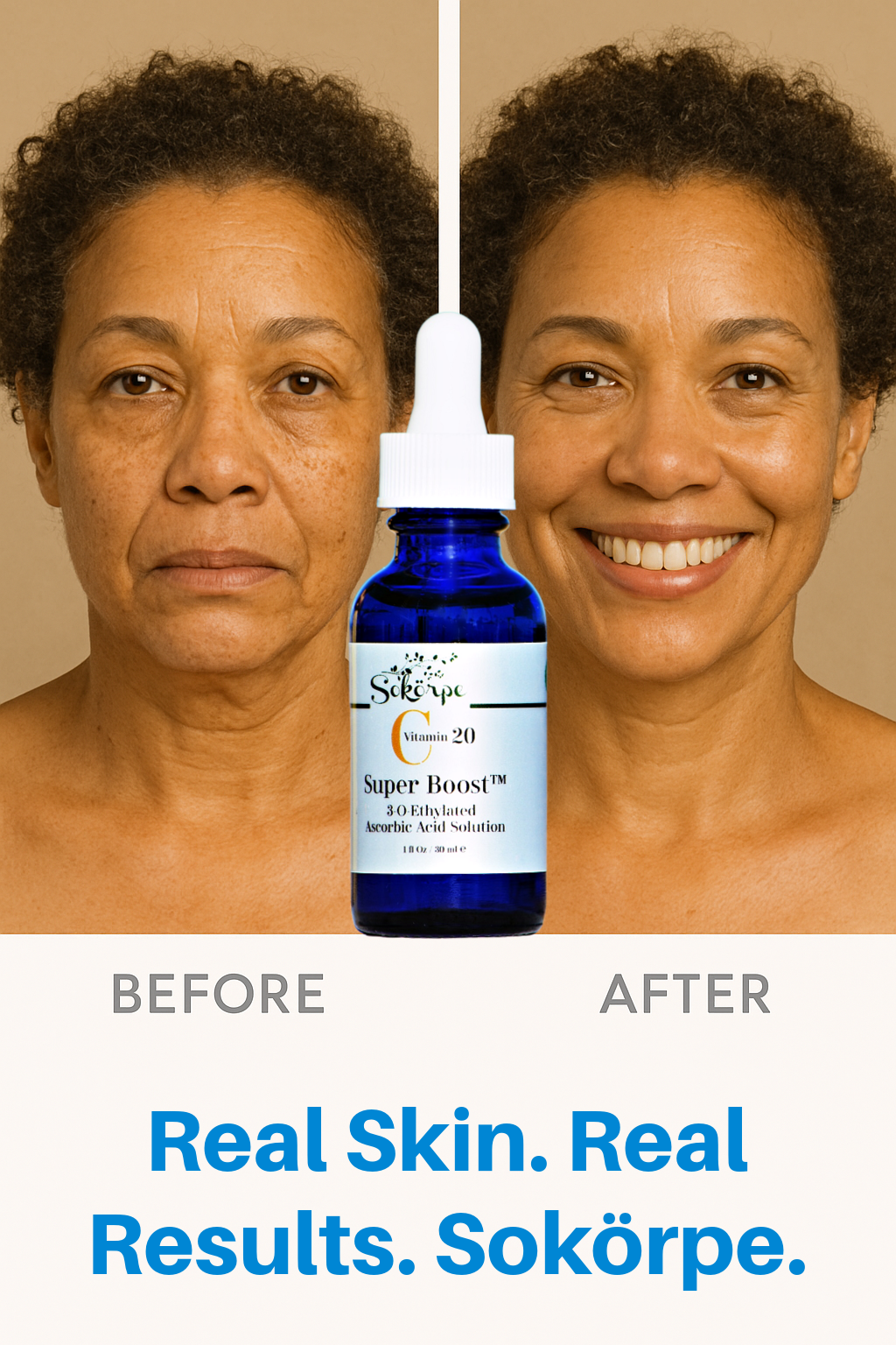 What to Do Against Skin Hyperpigmentation and Dark Spots?