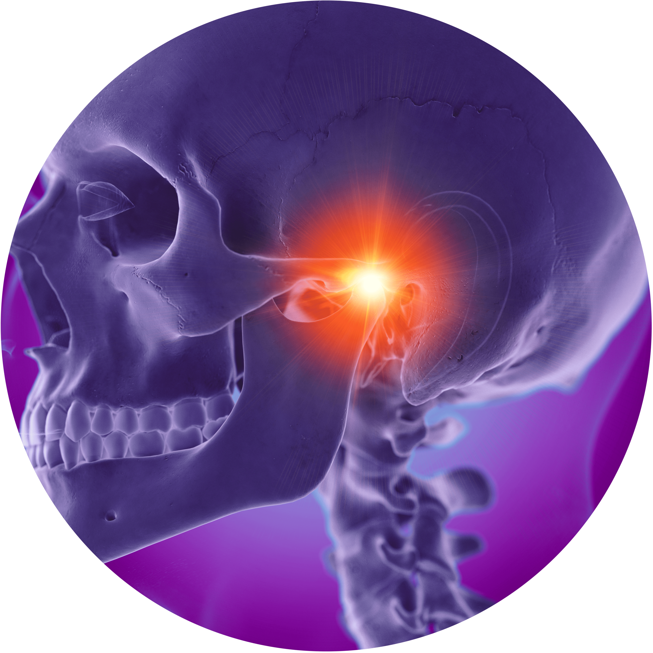 TMJ Pain &amp; Headaches