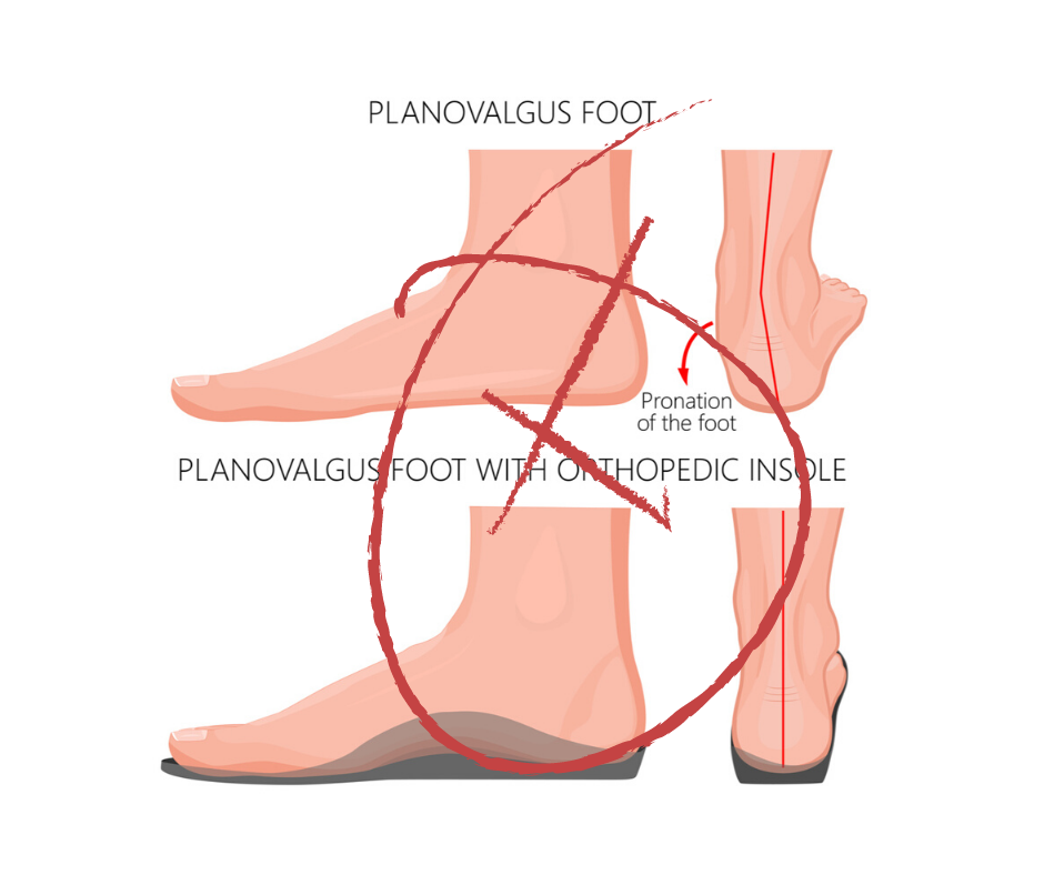 Podiatrists no longer prescribe to “ROOT” theory
