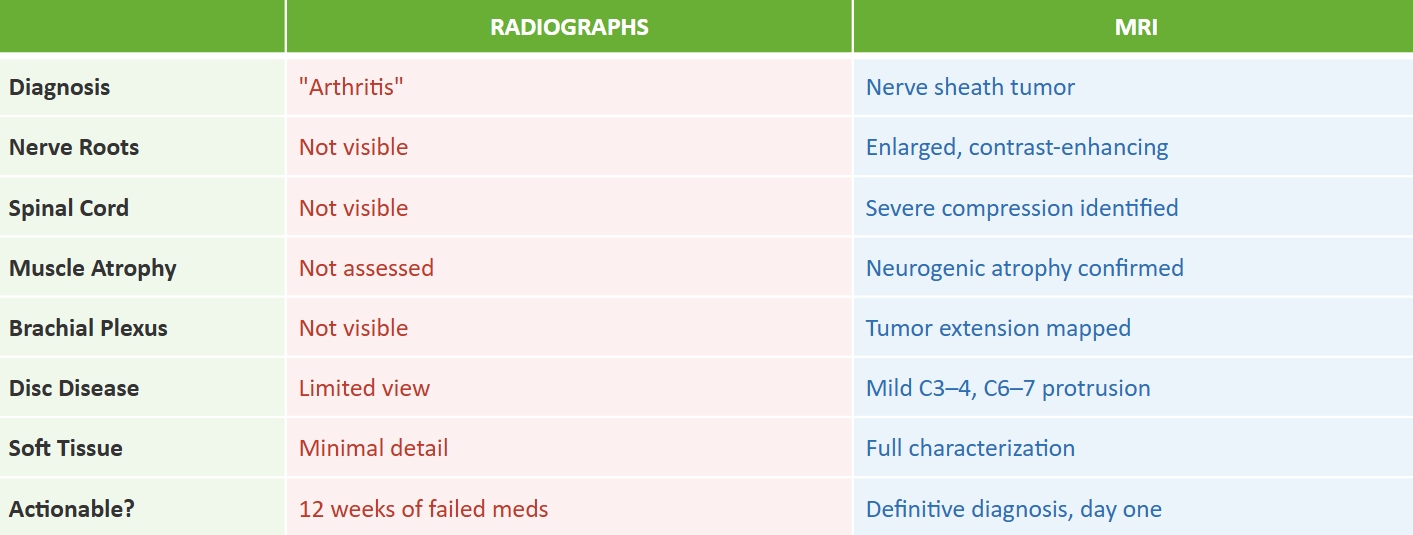 Table comparing radiographs and MRI findings in a dog with forelimb lameness, showing missed nerve and spinal cord pathology on X-rays versus definitive diagnosis on MRI