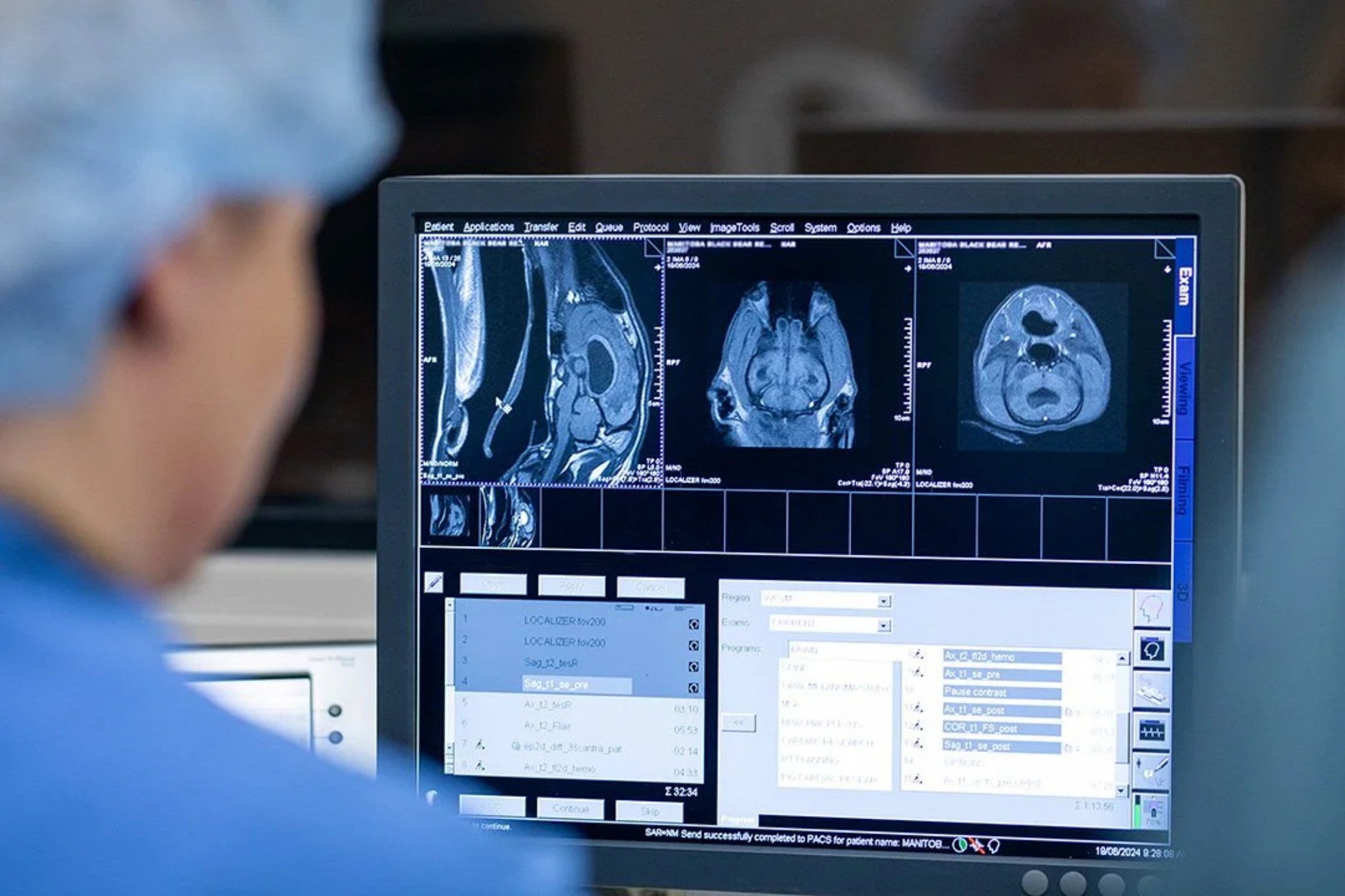 Veterinary professional reviewing MRI images on a diagnostic workstation