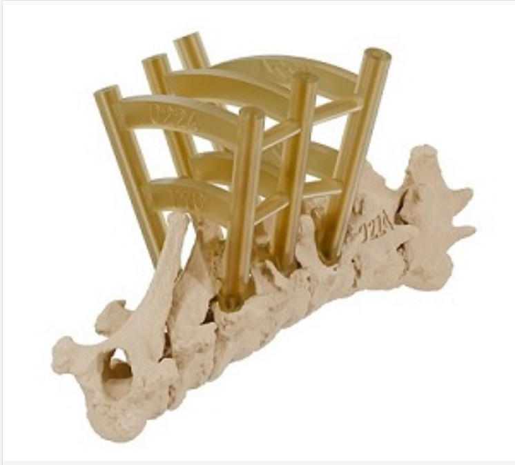Image of 3D-printed drill guide for spine. Courtesy of The Royal School of Veterinary Studies, University of Edinburgh