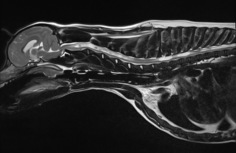 MRI image of a dog’s brain and cervical spine showing Chiari-like malformation and syringomyelia.