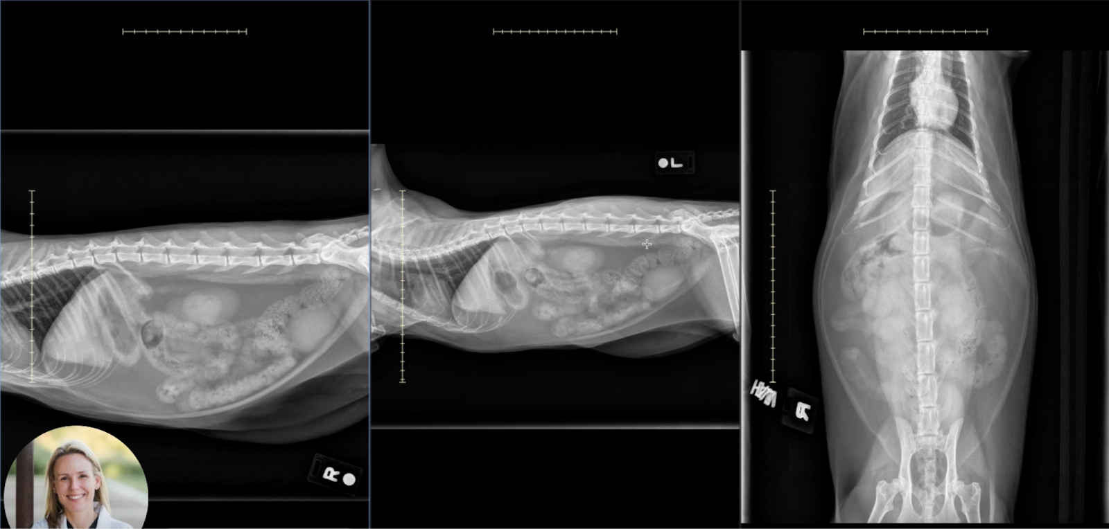 VD abdominal radiograph of a cat with serpentine, radiating plicated small intestines and fragmented gas pattern, diagnostic for LFBO.