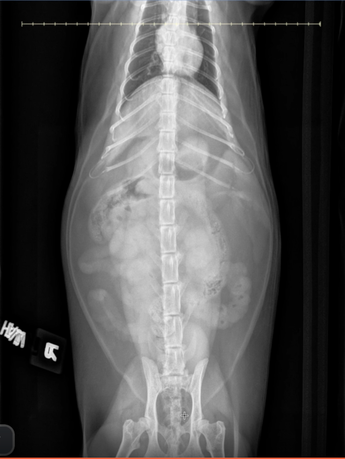 VD abdominal radiograph of a cat with serpentine, radiating plicated small intestines and fragmented gas pattern, diagnostic for LFBO.