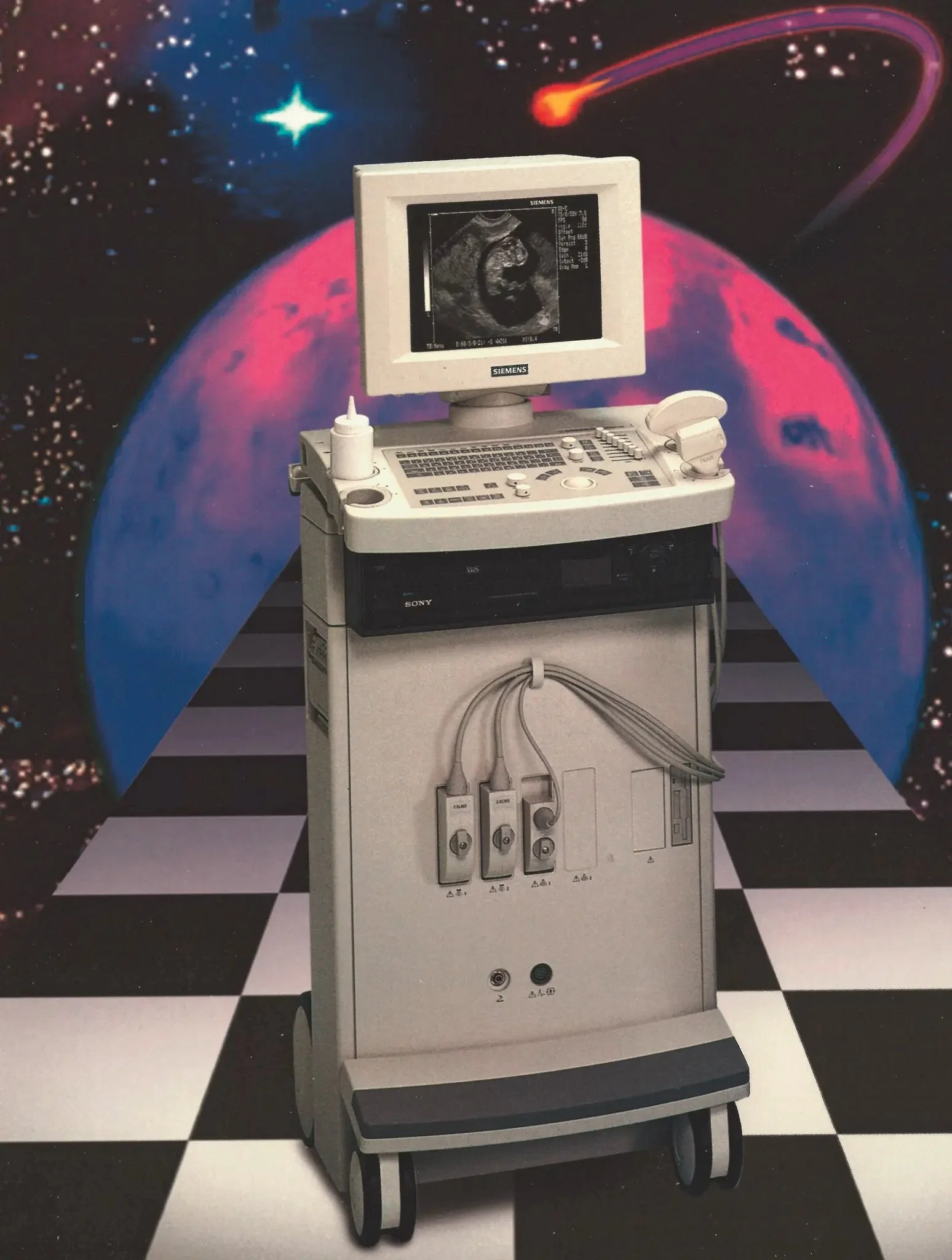 The SONOLINE Prima, launched in 1995, was Siemens’ first ultrasound system with digital workflow. Photo courtesy of Siemens Healthineers
