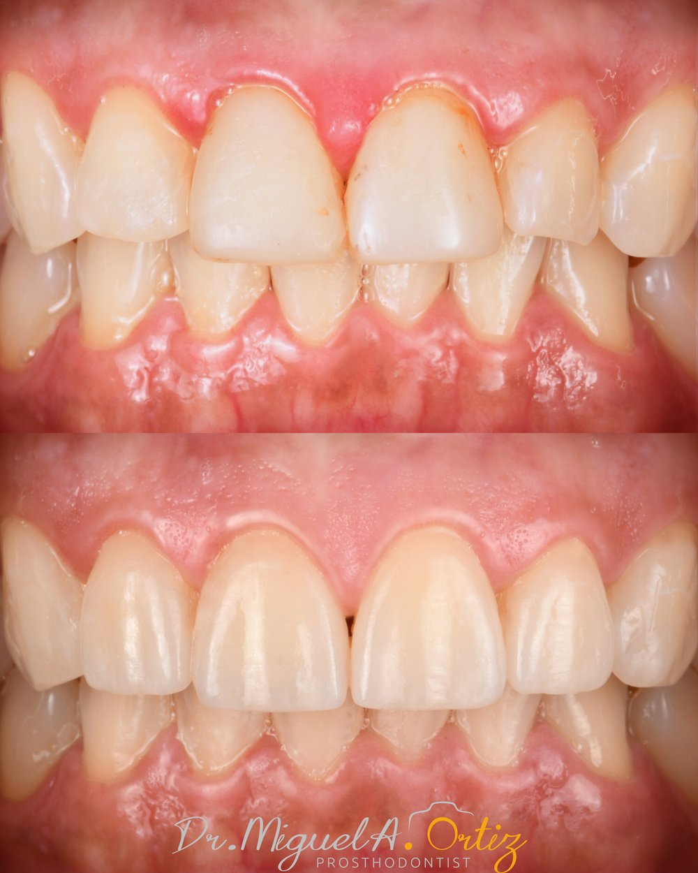 Lit Dental Esthetics & Implant Center