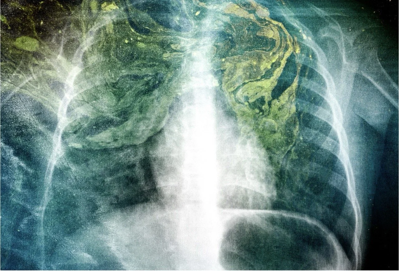 une écologie des images