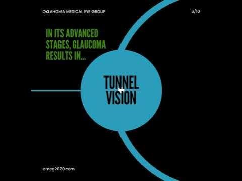 Glaucoma Education - Social Media Video Short