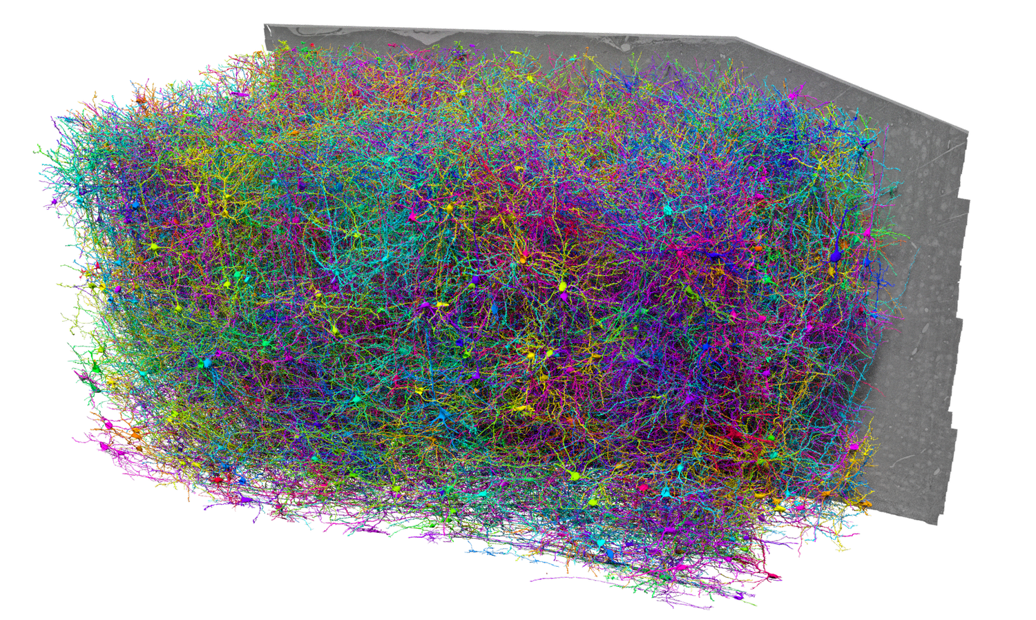 Color Atlas of Microneurosurgery of … Amazon.com: Color Atlas of Microneurosurgery: Volume 1