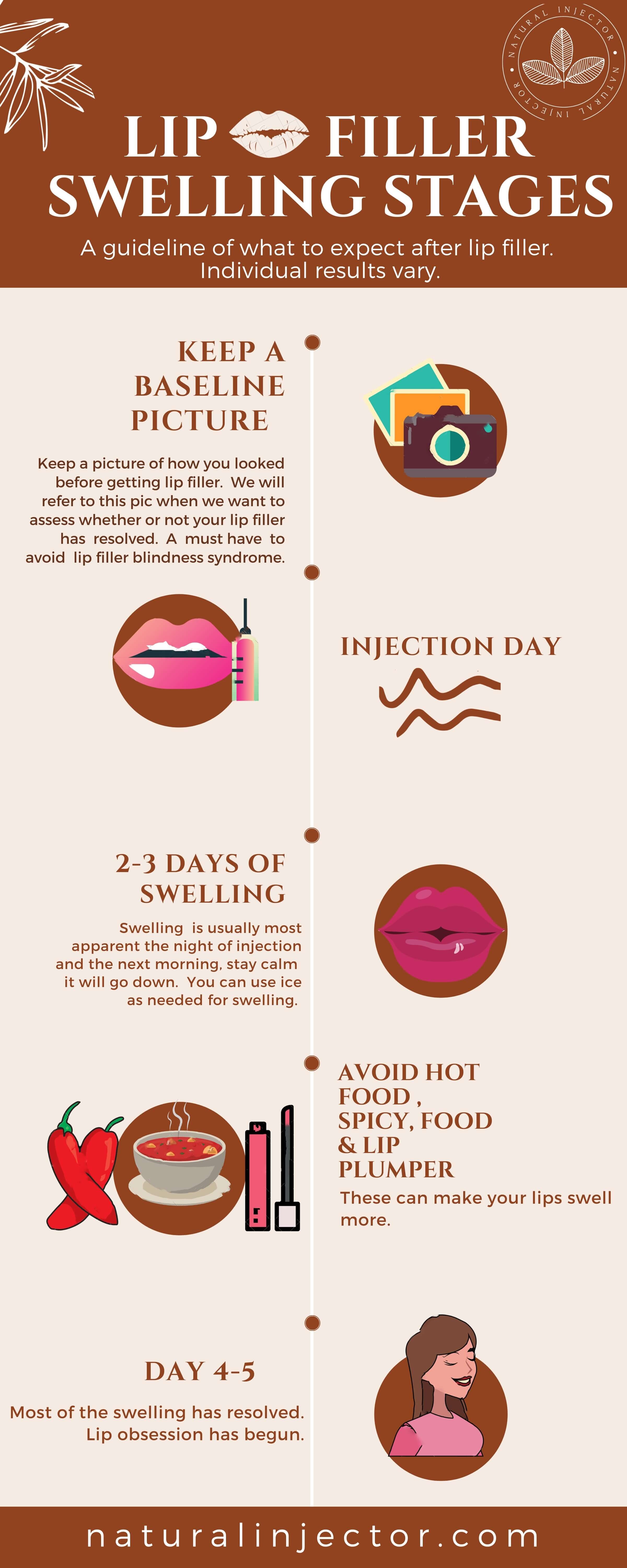 How to Avoid Lip Filler Migration & Botched Lips- 5 Tips YOU NEED to ...