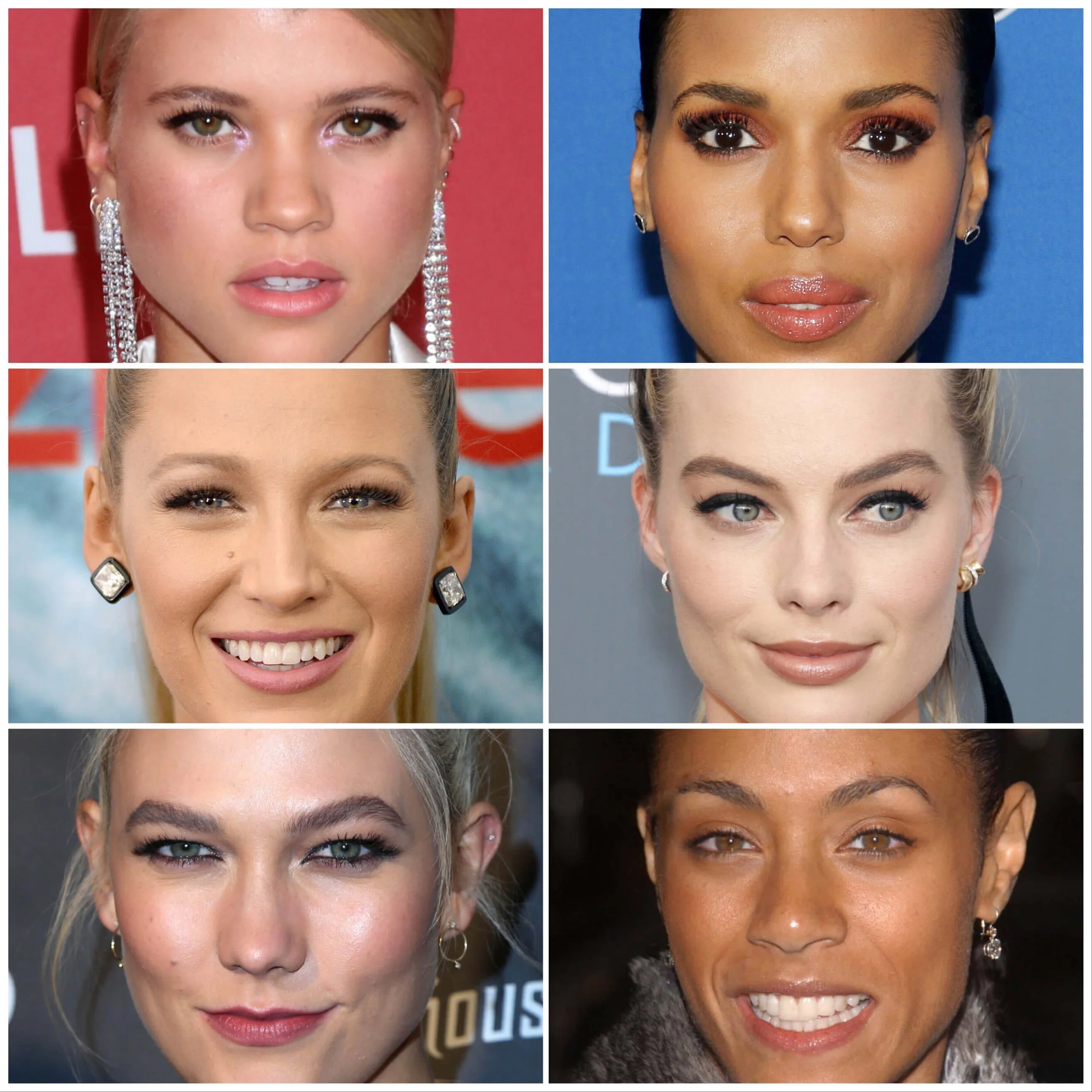 Botox Eyes Before And After