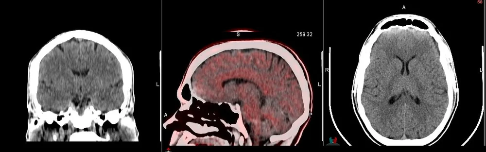 Neurology — Adler Imaging