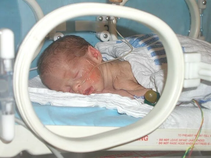 משכן חדש לפגים