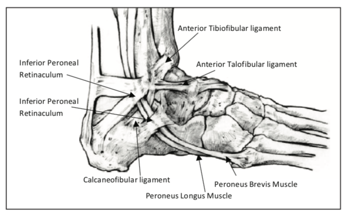 ANKLE SPRAINS
