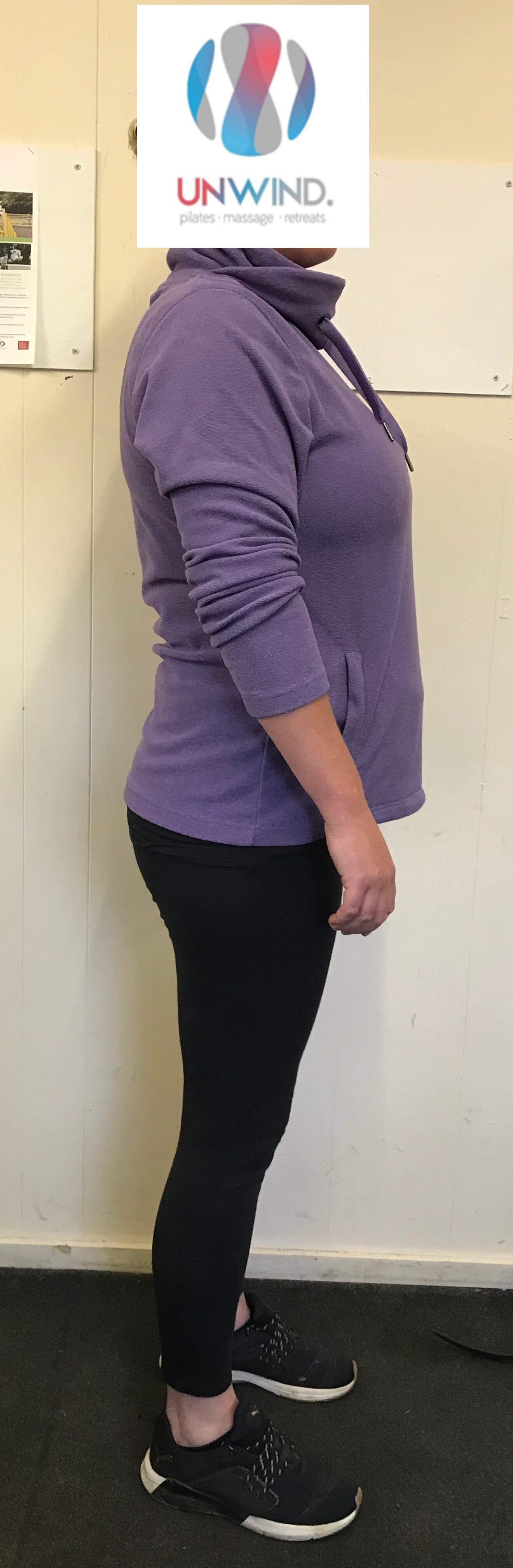 b. Right side week 1