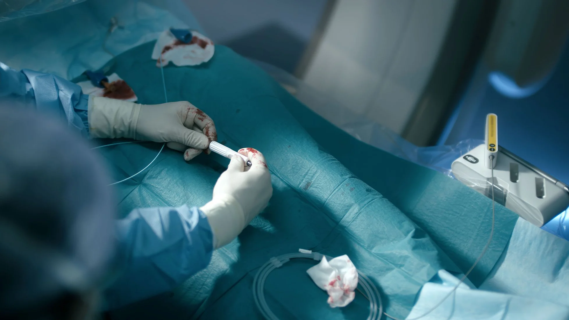 FORS - Fiber Optic Real Shape (confidential)