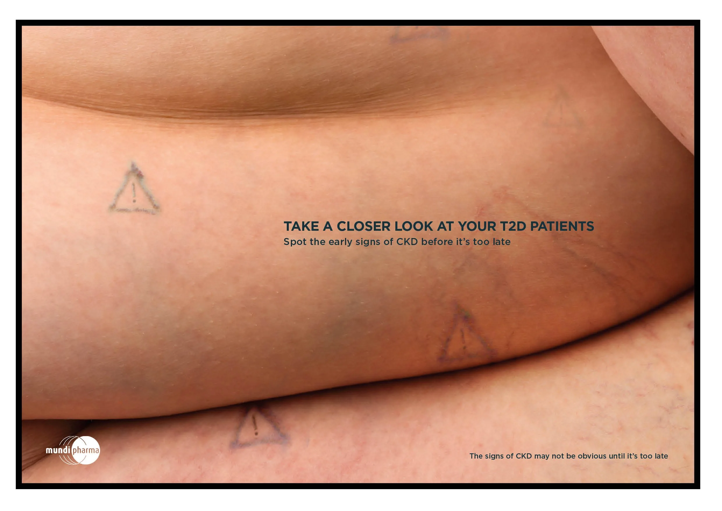 MundipharmaAwarenessSigns.jpg