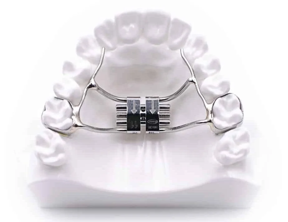 Appliances Overview — TriValley Orthodontics Dr. Jesse Ko & Dr. Anne