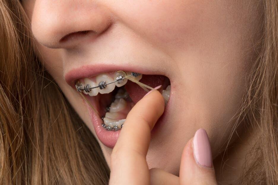 elastics1.jpg