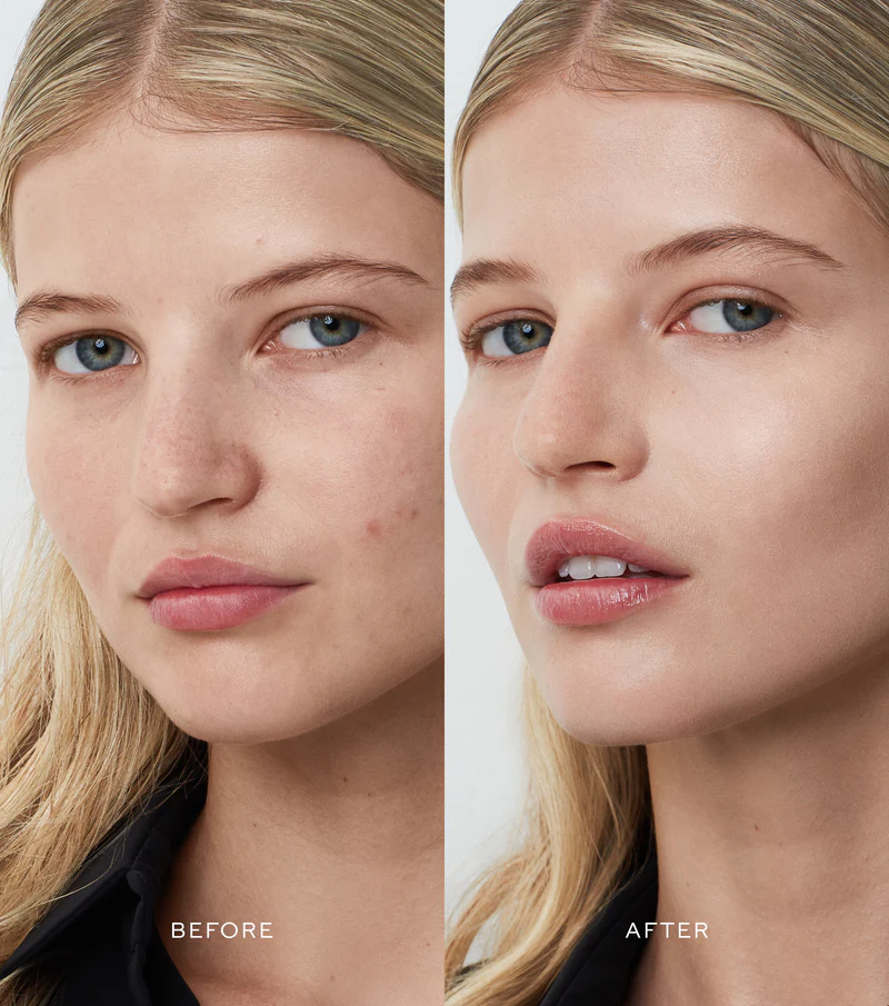 PT_Complexion-Drops1_BeforeAfter4.png