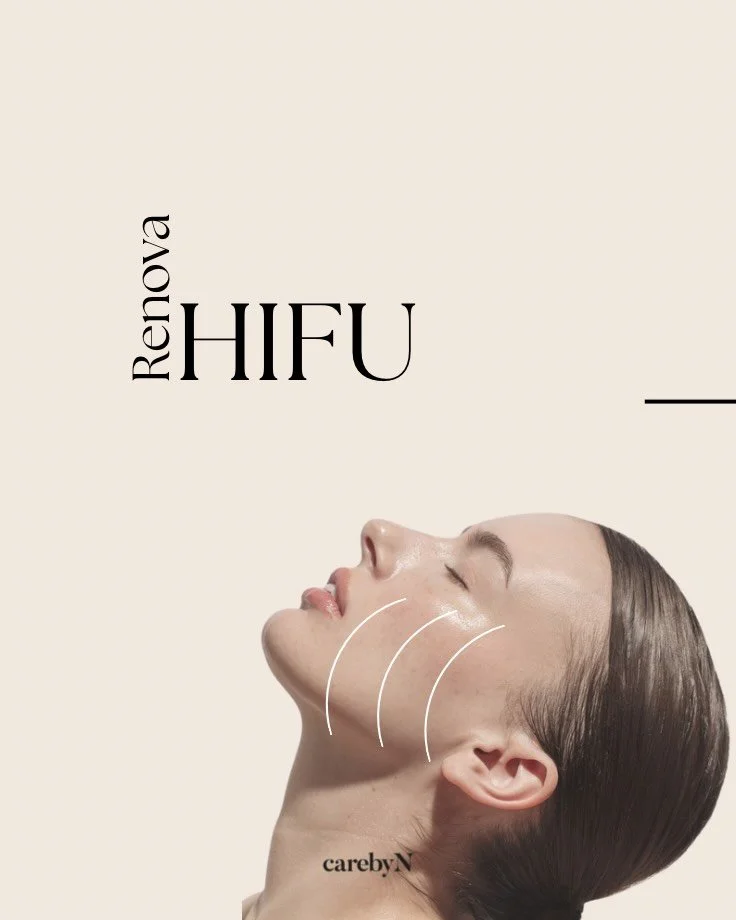 HIFU &ndash; High Focused Ultrasound

- Motverkar och f&ouml;rebygger synliga &aring;lderstecken
- Ger l&aring;ngvariga och naturliga resultat
- Reducerar dubbelhaka och skapar en mer definierad k&auml;klinje
- Uppstramande och utj&auml;mnande effekt