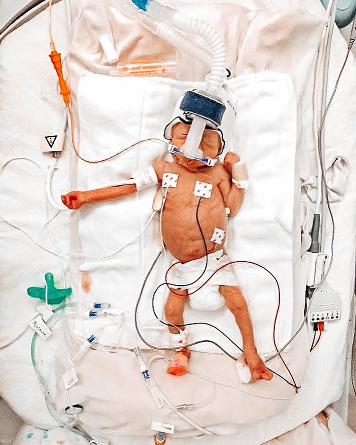 ✨𝐇𝐀𝐍𝐃𝐎𝐅𝐅 𝐑𝐄𝐏𝐎𝐑𝐓✨

(𝐏𝐚𝐫𝐭 𝟏/𝟐)

After huddle, report begins. A NICU report looks much different than the adult world and includes ALL (if not MOST) of the following, depending on your facility:

𝐆𝐄𝐍𝐄𝐑𝐀𝐋 👶🏼
1. Baby&rsquo;s na