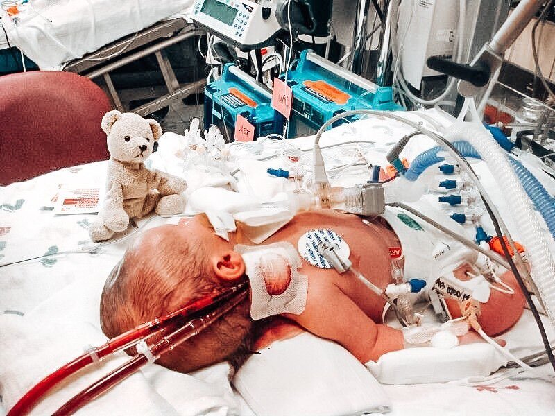 Just as preemies&rsquo; lungs, eyes, &amp; other body systems are fragile, so are their brains. 🧠 One common complication seen in very premature infants is minor bleeding in the brain.🩸Fortunately, this bleeding does not occur in actual brain tissu