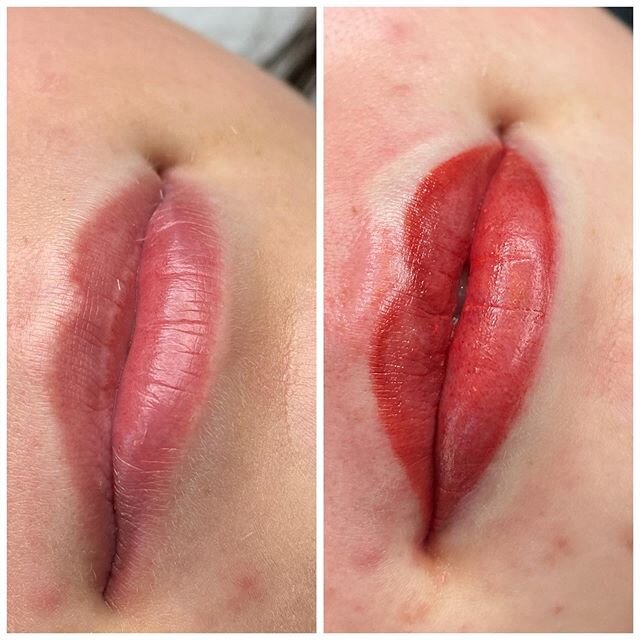 Lippigmentatie ❤️ De eerste 2 dagen zullen de lippen er donker uitzien. Na het contact met water zullen de lippen korstjes krijgen &amp; beginnen te vervellen waardoor u pigmentverlies zult hebben. Dit is allemaal normaal &amp; hoort bij het genezing