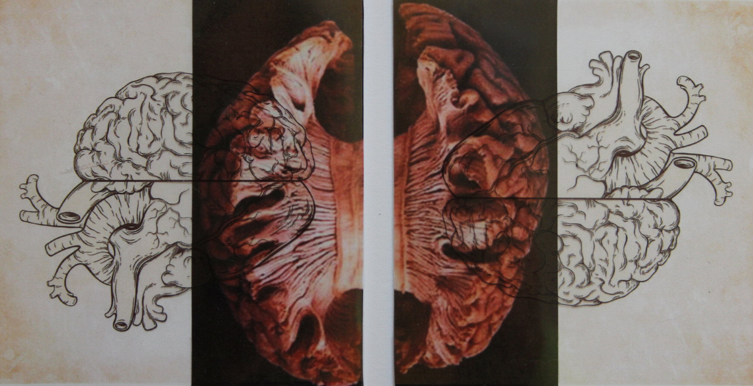 we need both sides 2018, 17 x 11 inches digital images, transparencies Liminal Space DMZ Museum South Korea June 22-Dec 22, 2018 My work is about the imagined liminal space between the right and left hemispheres of the brain. Each hem