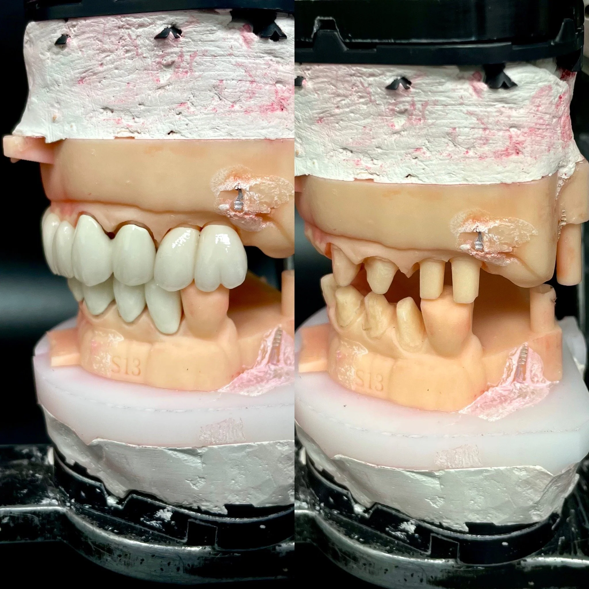 Golden Cusp Dental Labs Floral Park at Nancy Sheridan blog