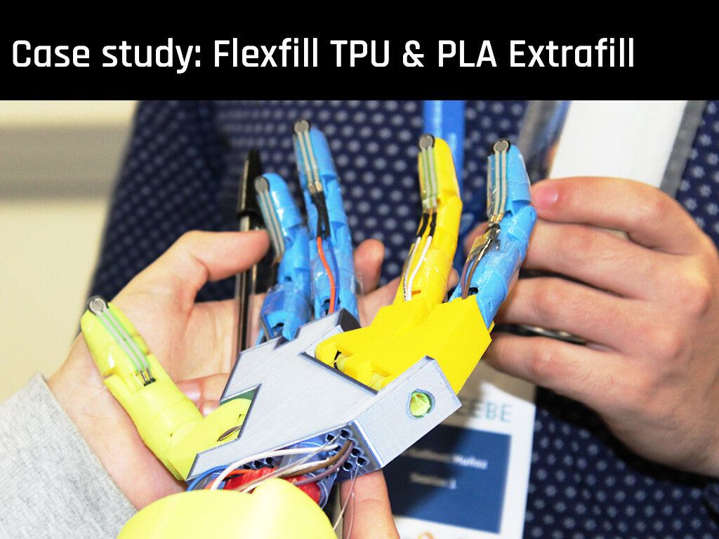 FabLab_EBBE_myoelectric prosthesis.jpg