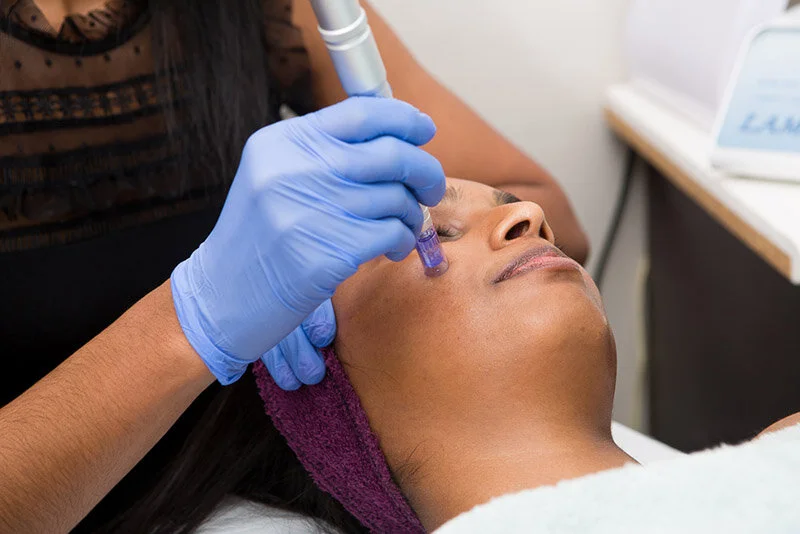 Microneedling / Dermapen